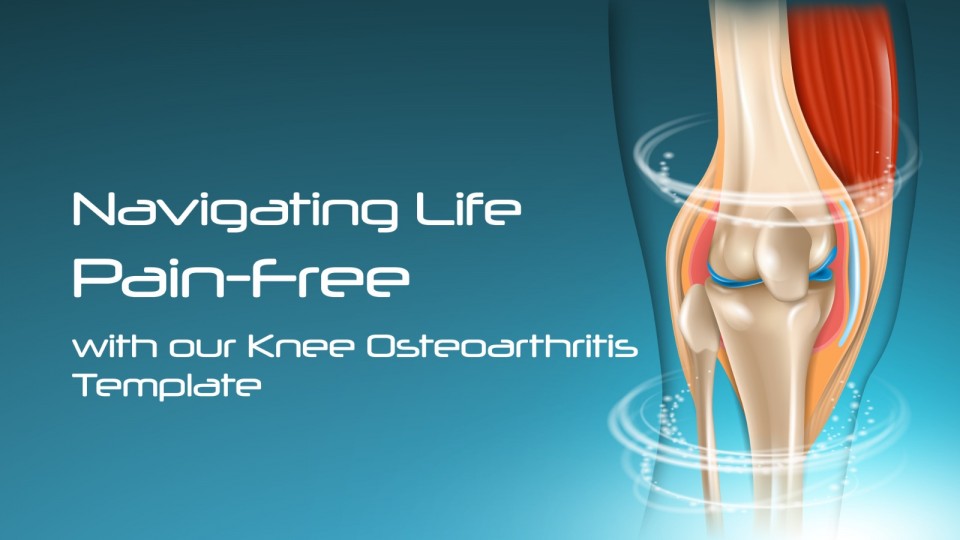 Navigating Life Pain-Free with our Knee Osteoarthritis Template